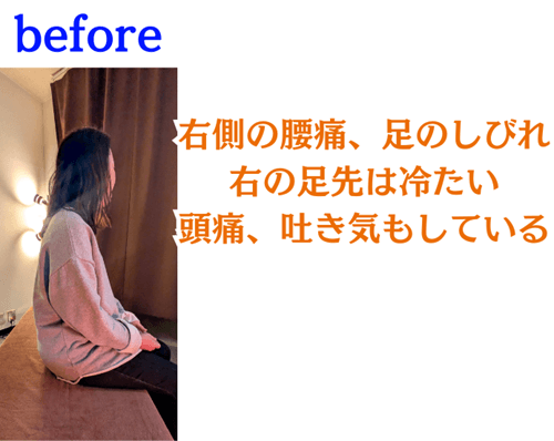 施術前の様子