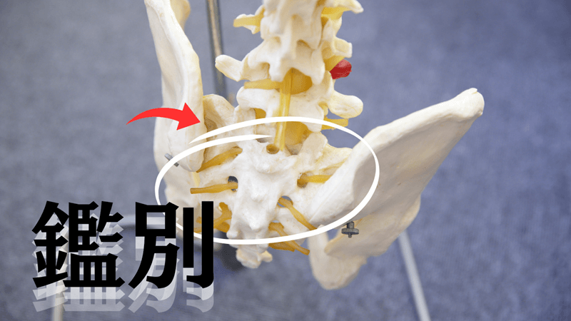 仙腸関節炎の原因