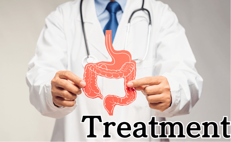 過敏性腸症候群（IBS）とは｜病院での正式な説明