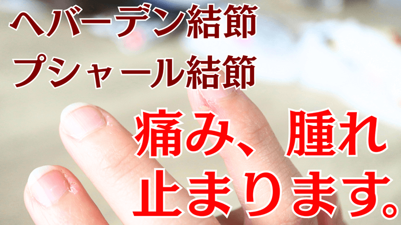 ヘバーデン結節とプシャール結節